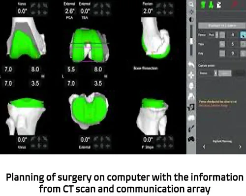 Robotic Surgery – illustration 4