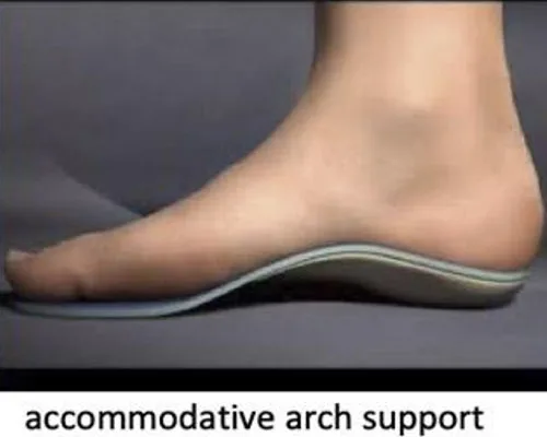 Flat Feet – illustration 5