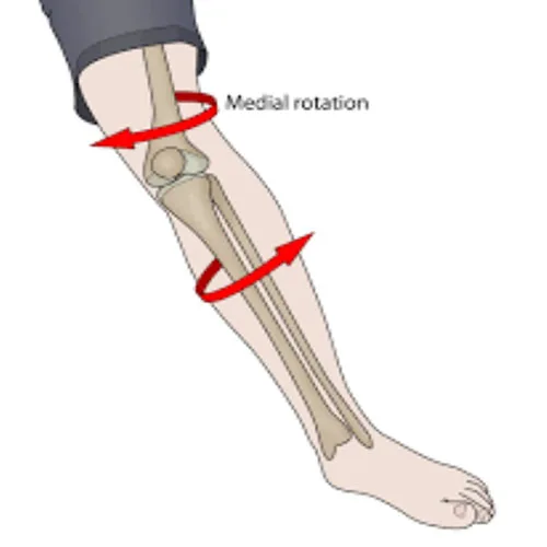 ACL Injury