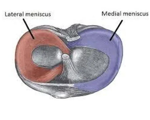 Knee Meniscus Injury